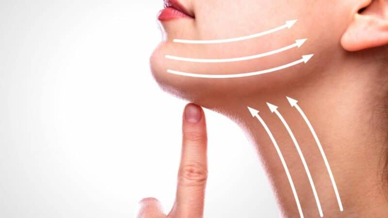 מתיחת צוואר