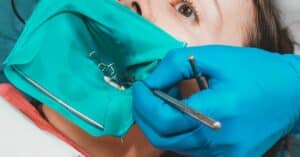 שיקום שיניים